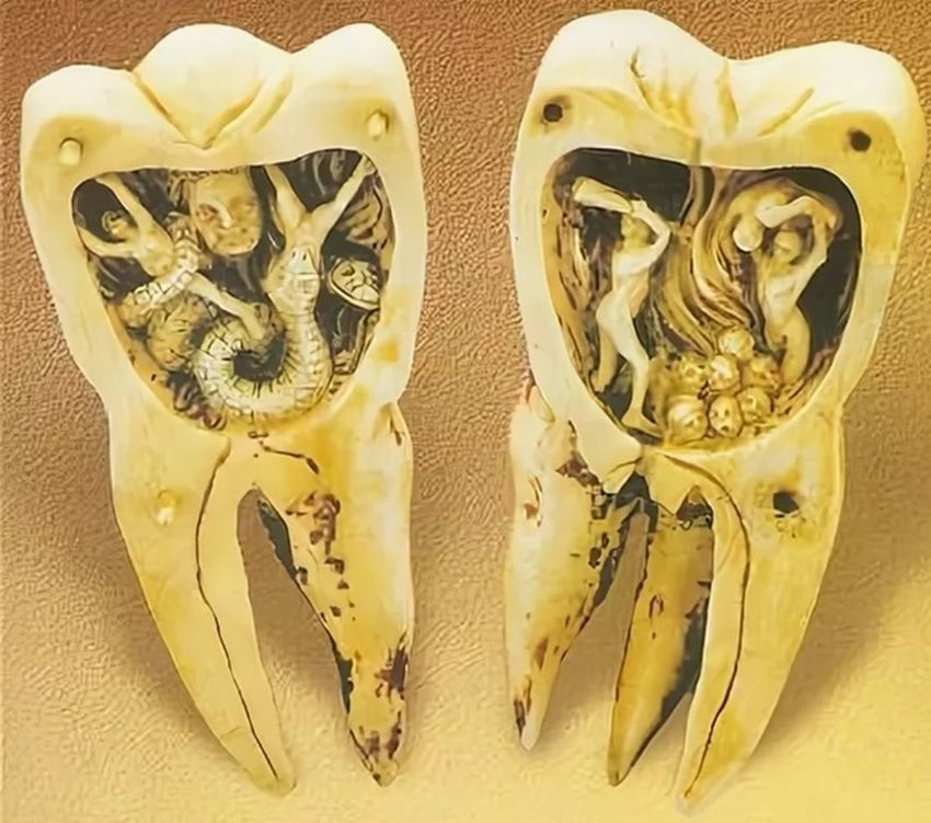 Зубной червь