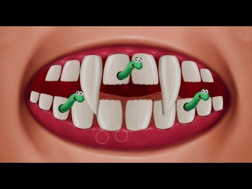 Зубы кариес