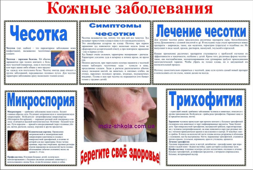 Чесотка памятка Болезнь чесотка