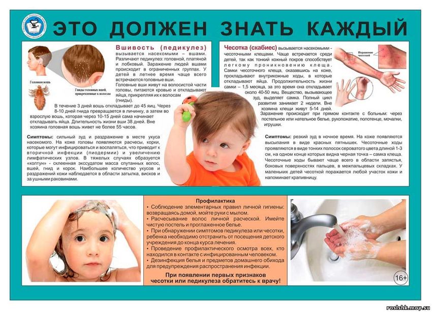 Профилактика педикулеза у детей Педикулез памятка