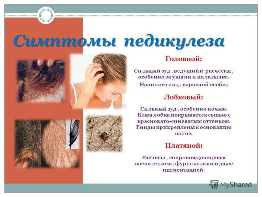 Симптомы педикулеза Педикулёз