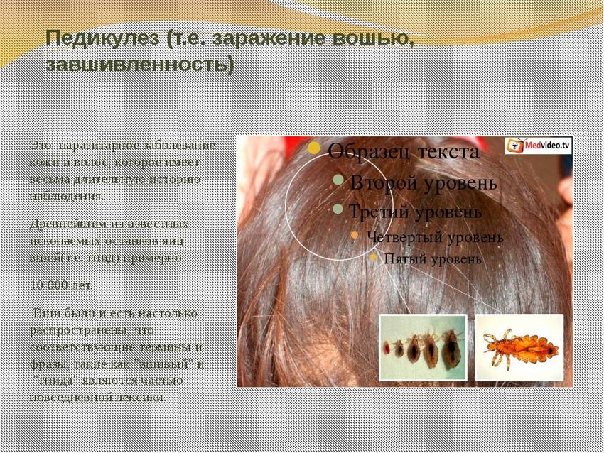 Педикулёз Вши педикулез