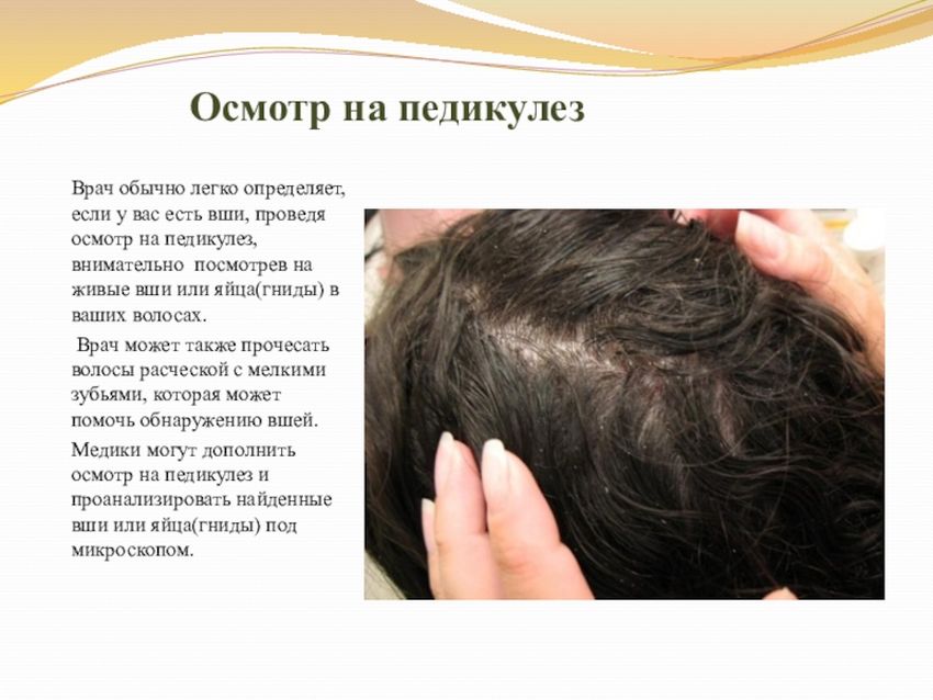 Что такое педикулез у детей с картинками