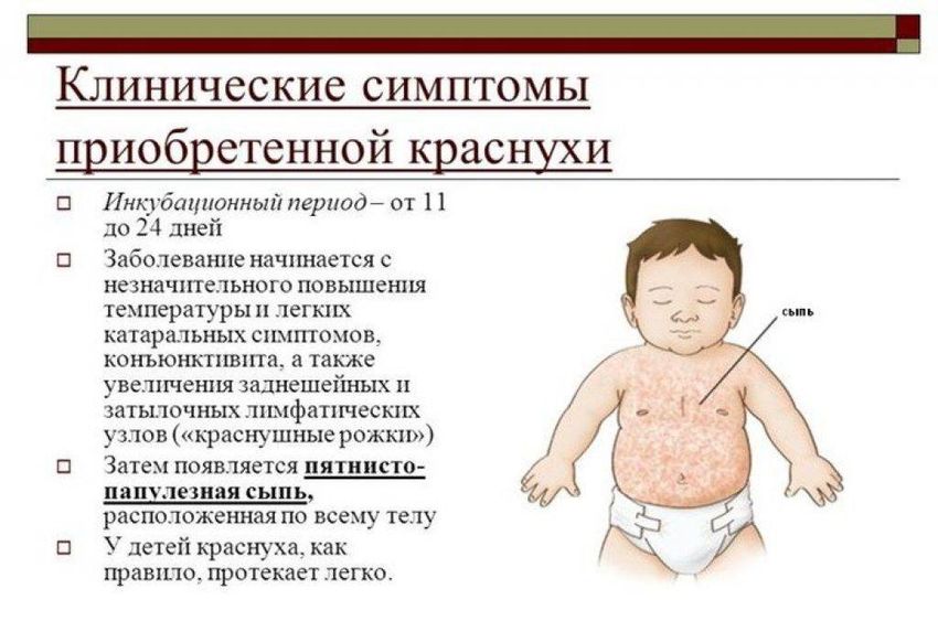 Краснуха Краснуха симптомы