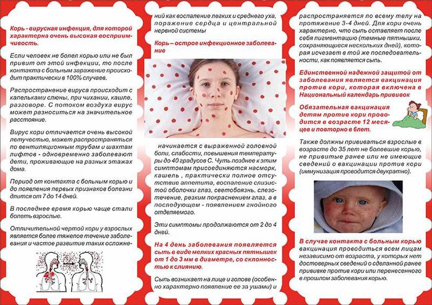 Корь Корь памятка