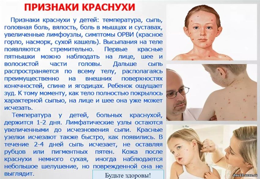 Краснуха сыпь симптомы у детей Краснуха