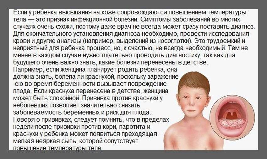 Скарлатина симптомы у детей Ангина у детей