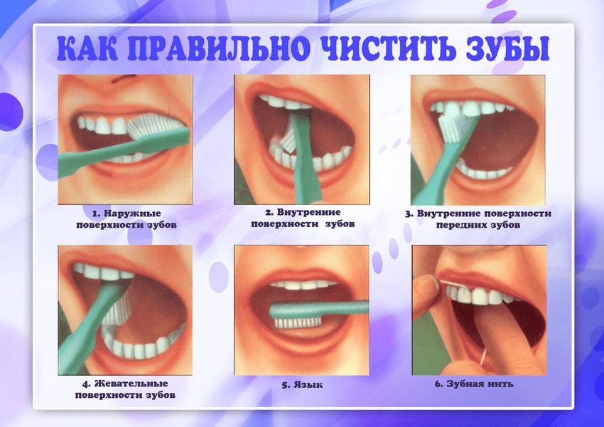 Правильная чистка зубов