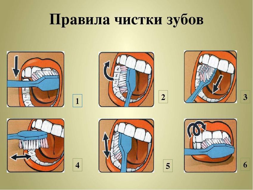 Техника чистки зубов