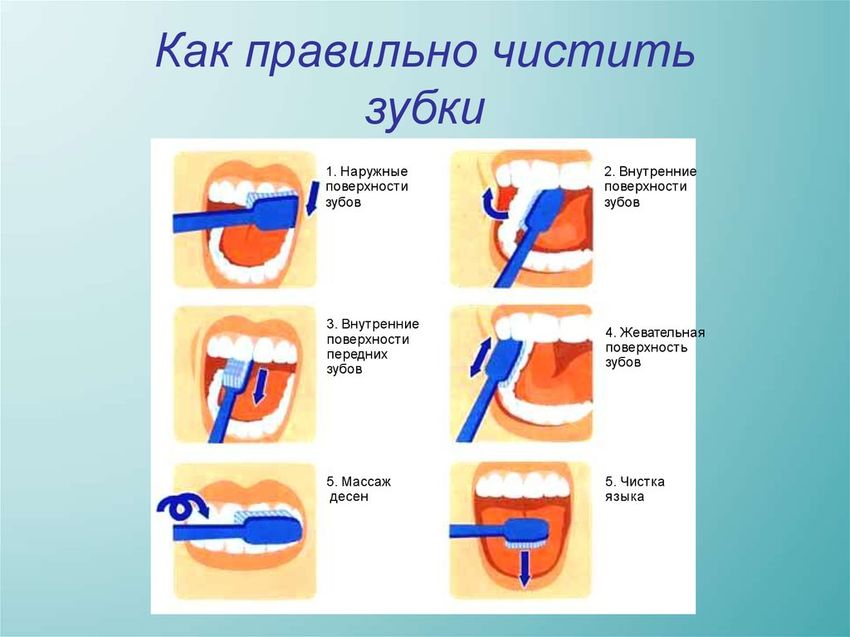 Схема правильной чистки зубов