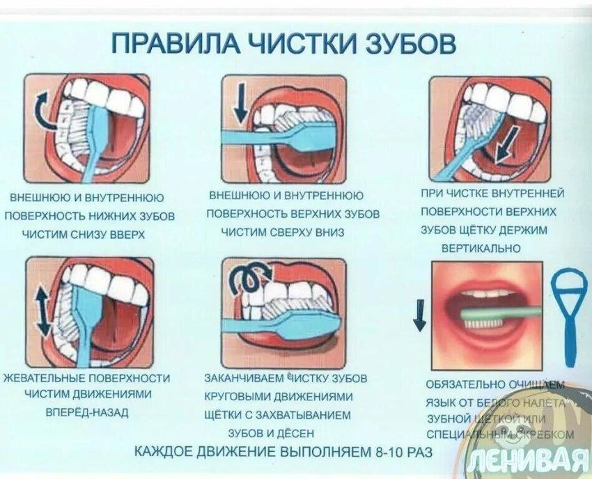 Правильная методика чистки зубов зубной щёткой
