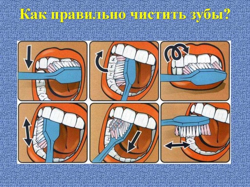 Схема правильной чистки зубов
