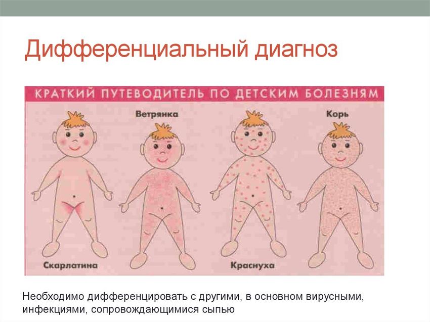 Сыпь у детей дифференциальная диагностика с картинками