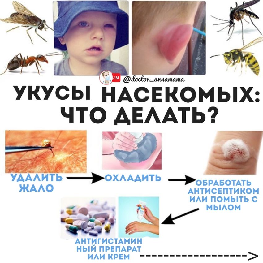 Первая помощь при укусах насекомых