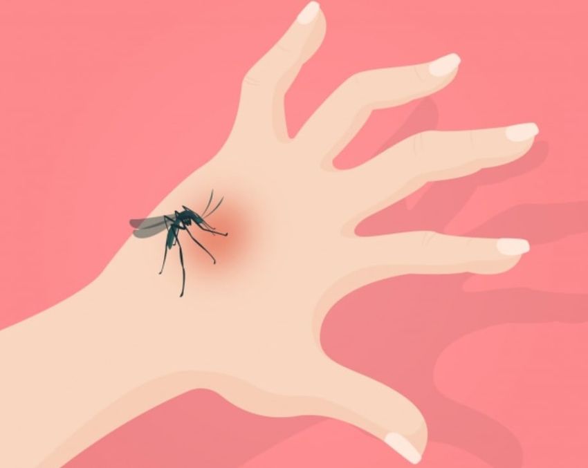Mosquito bite