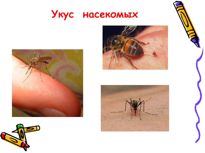 Укусы насекомых