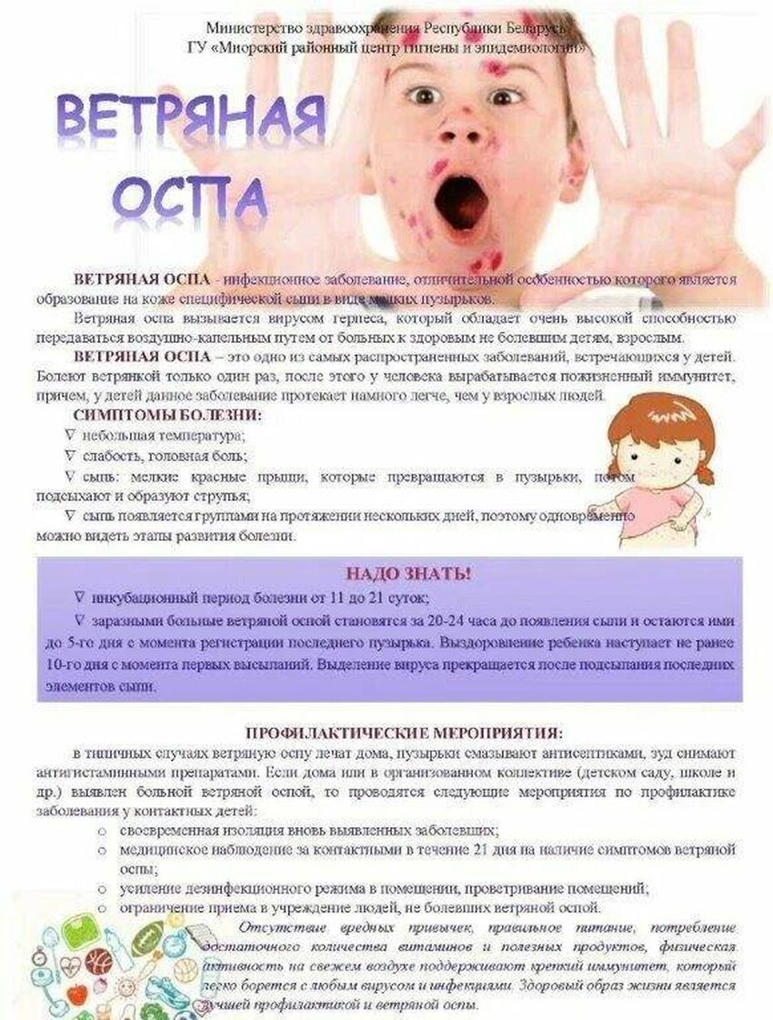 Ветряная оспа у детей памятка
