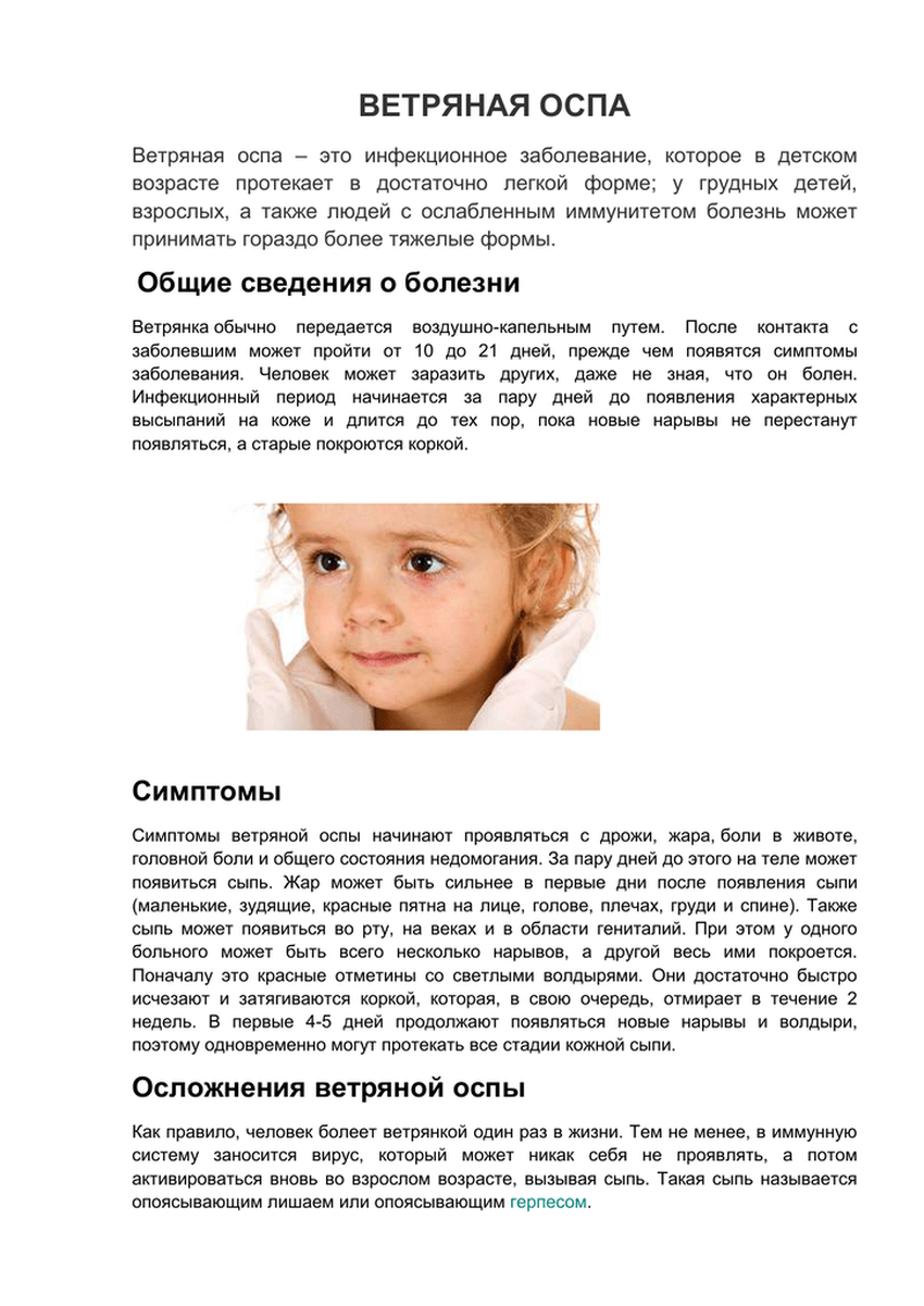 Ветряная оспа у детей