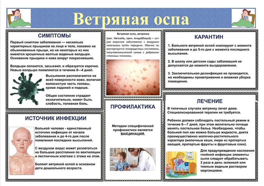 Памятка для родителей по детским болезням ветряная оспа