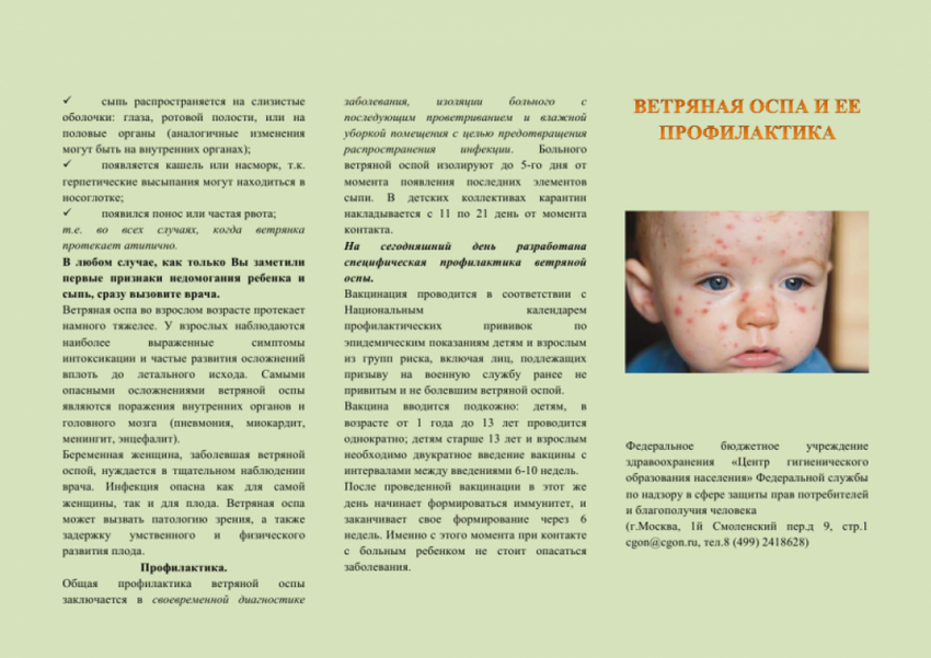 Буклет на тему ветряная оспа у детей