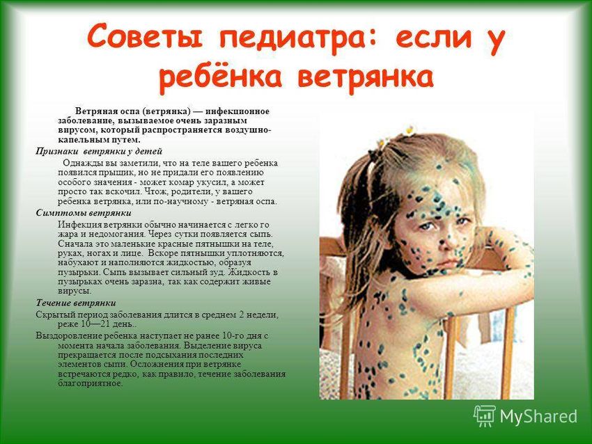 Ветряная оспа