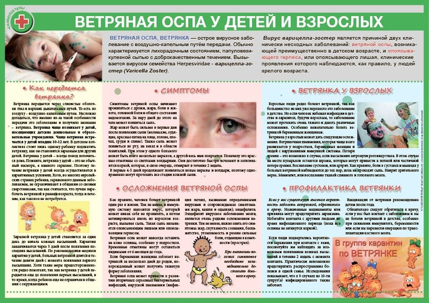 Ветряная оспа