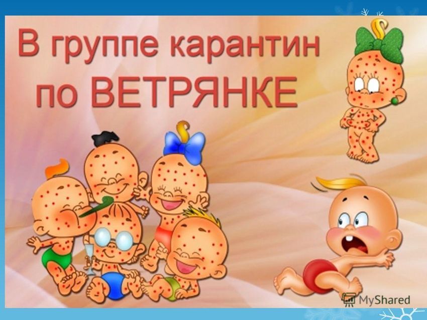 Ветряная оспа
