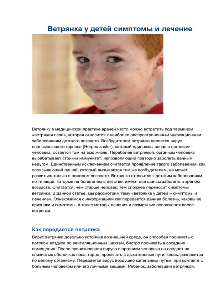 Ветряная оспа у детей