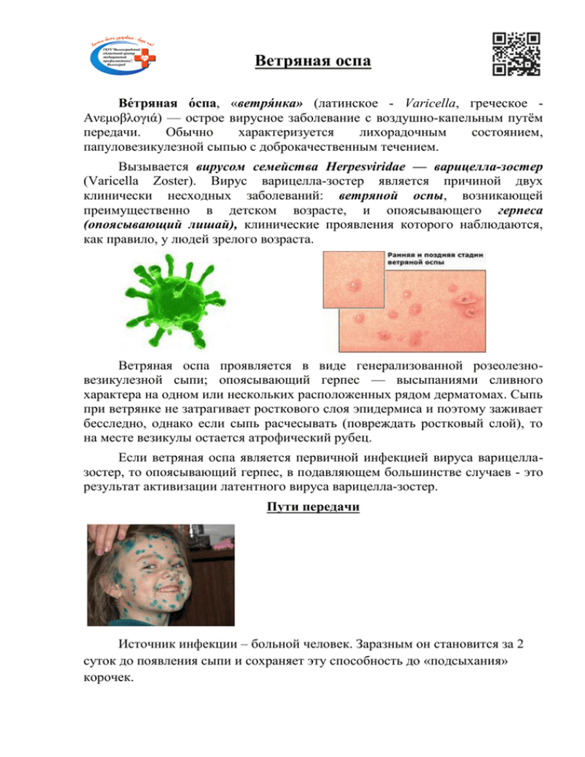 Ветрянка ветряная оспа у детей