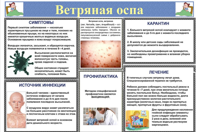 Ветряная оспа профилактика