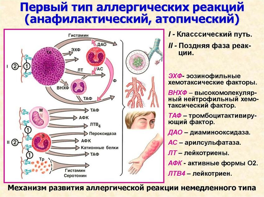 Аллергическая реакция Механизм аллергической реакции