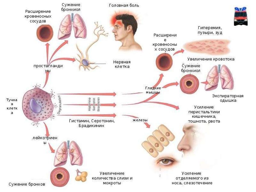 Аллергическая реакция Клинические проявления аллергических реакций