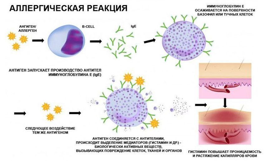 Аллергическая реакция Аллергическая реакция лечение