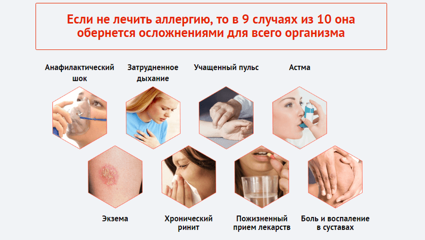 Аллергии Аллергическая реакция