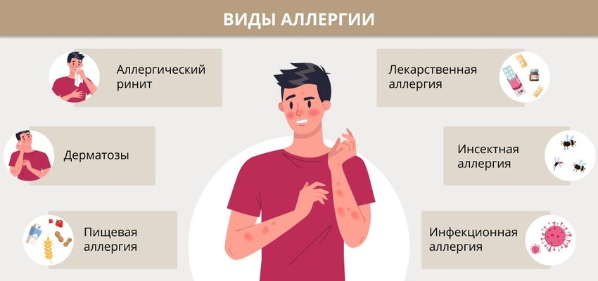 Симптомы аллергии Проявление аллергии